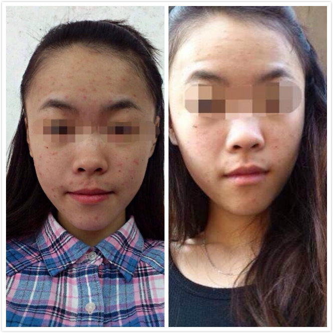 psb_meitu_1.jpg